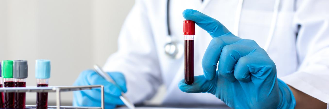 Boise medical Lab worker holding a test tube with a blood sample.