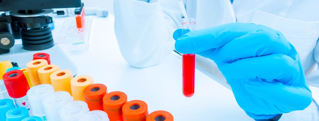 Lab worker with blood draw test tubes.