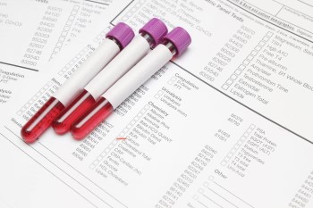 Collection tubes with requisition form.