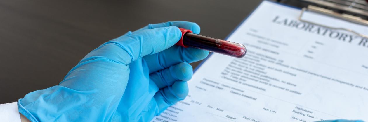 Medical lab endocrine testing concept: A laboratory worker with a plastic glove holding a blood sample in a test tube during a diabetes testing procedure.