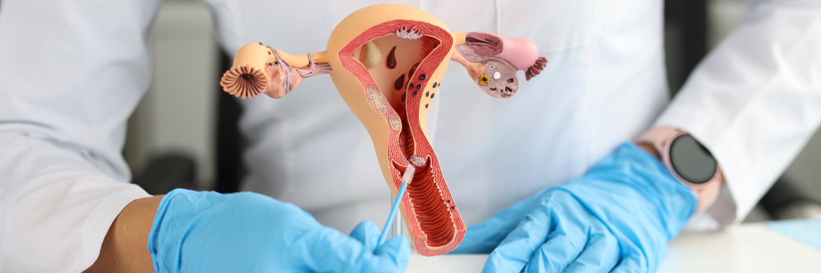 Medical laboratory testing for women through their obgyn doctors. An obgyn doctor with a human anatomy model explaining a procedure to a female patient as a result of medical laboratory testing.